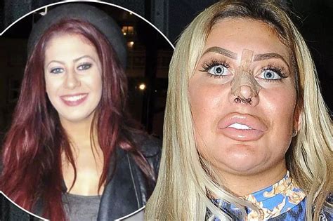 chloe ferry lipstick to buy|chloe ferry before and after.